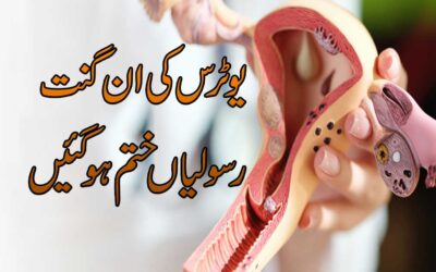 Uterus Ki Rasoli Se Shifa Ka Taweez