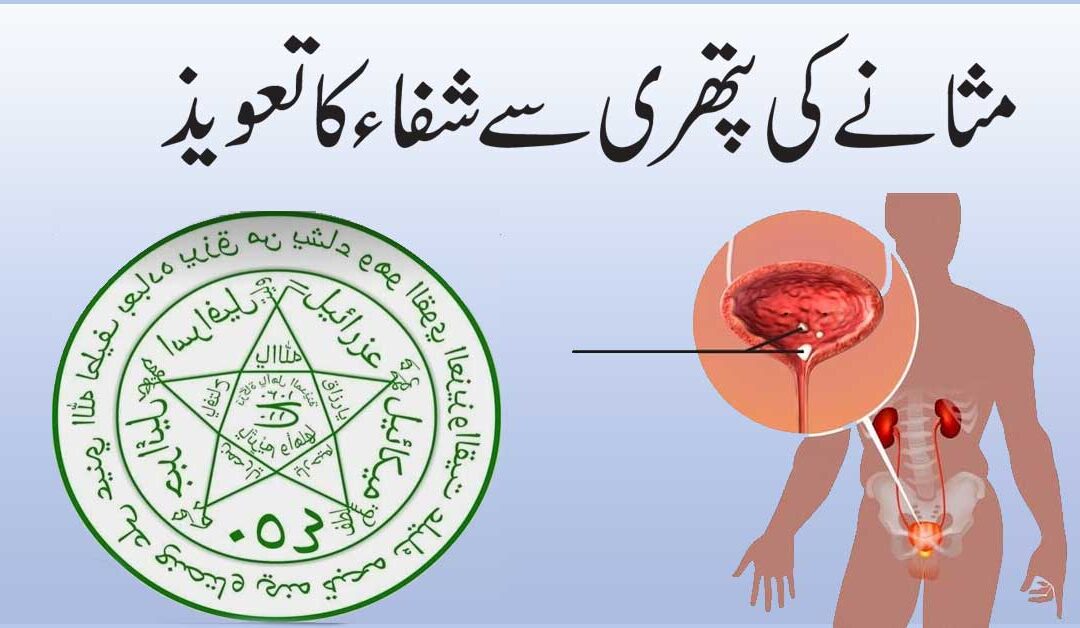 Masana Ki Pathri Ka Ilaj