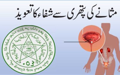 Masana Ki Pathri Ka Ilaj | Bladder Stone Treatment