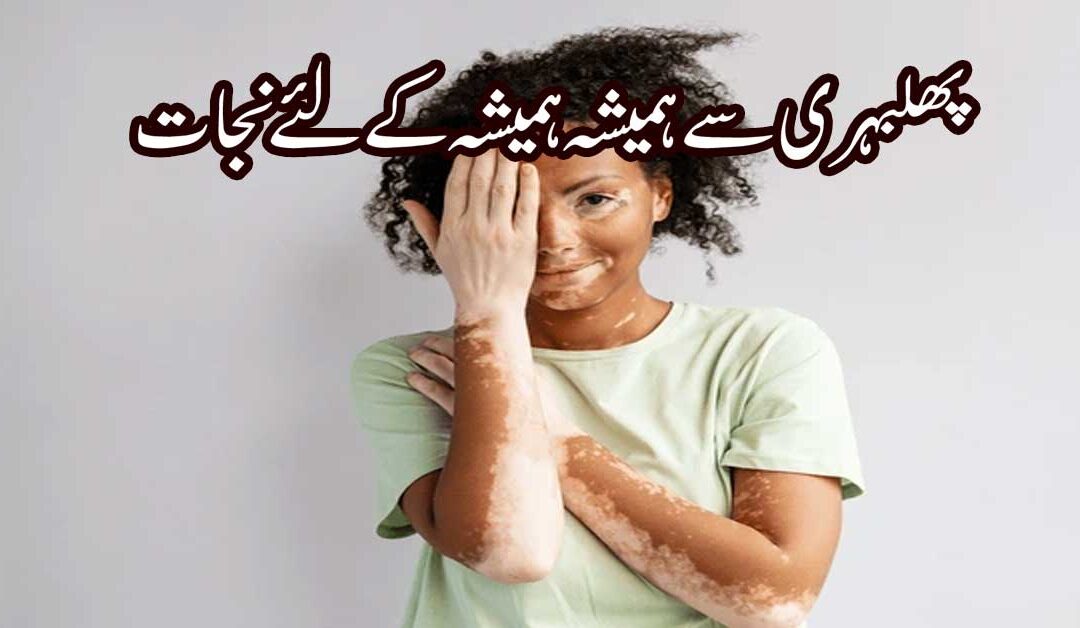 Phulbehri Aur Safaid Dagh Se Shifa Ka Taweez