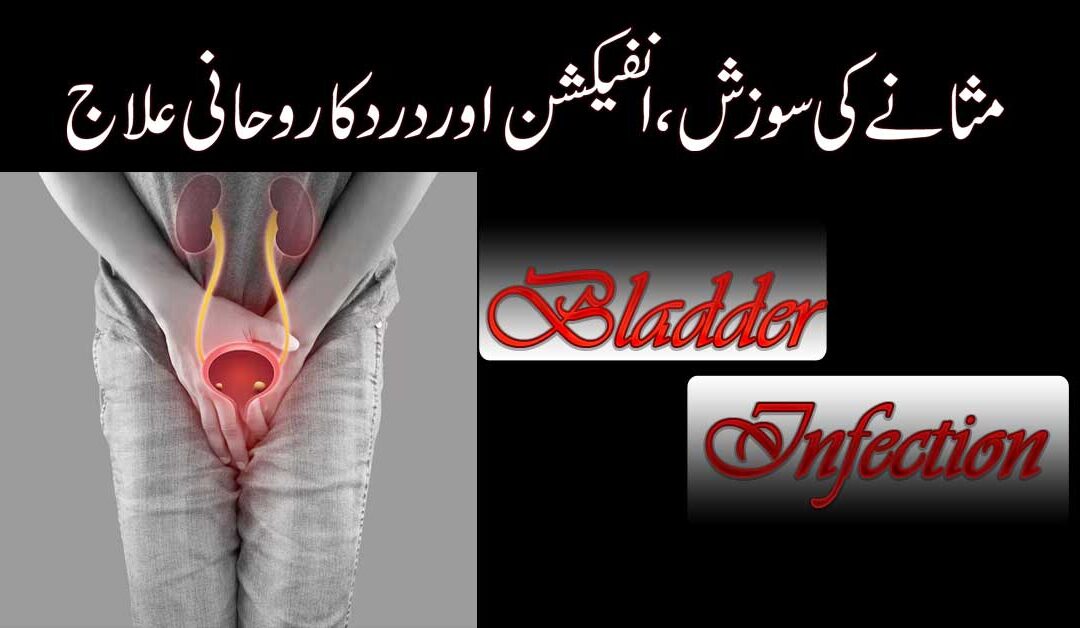 Best Treatment For Bladder Inflammation
