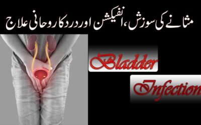 Best Treatment For Bladder Inflammation