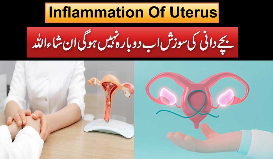 Bachedani Ki Sozish K Mukamal Khatma