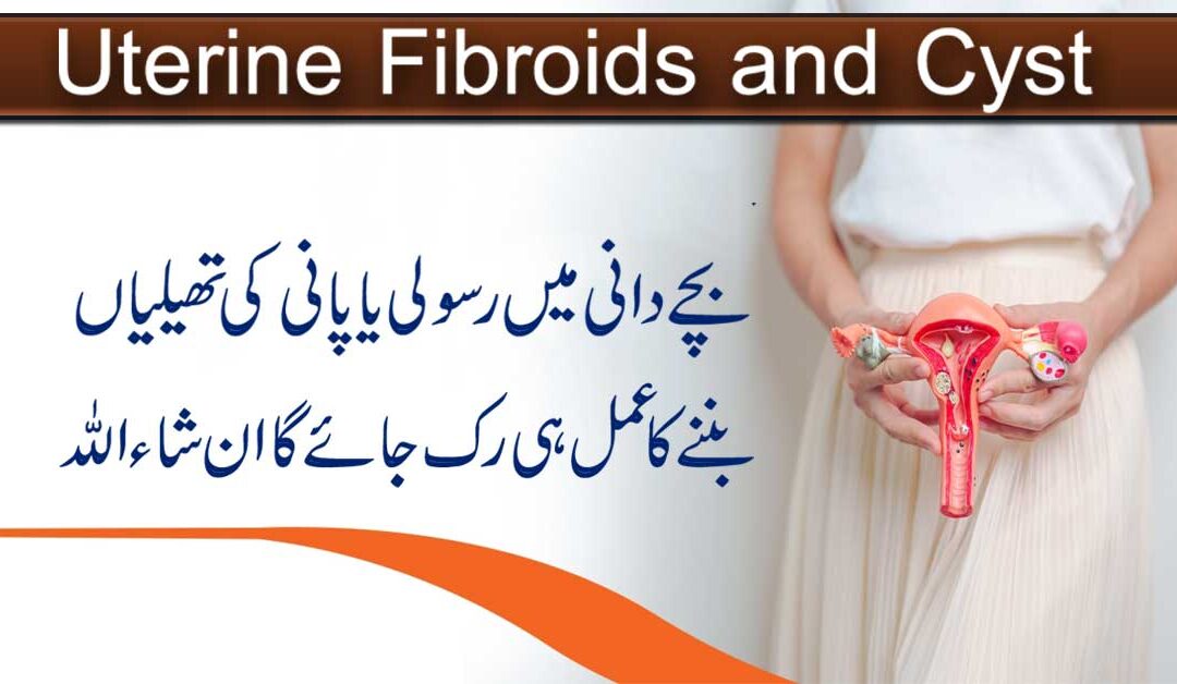Uterine Fibroids And Cyst