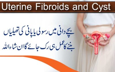 Uterine Fibroids And Cyst