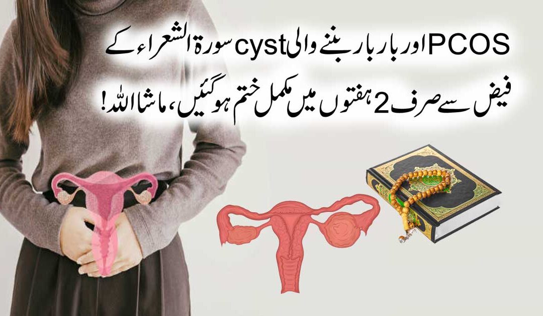 PCOS  Se Fori Shifa Ka Naqsh