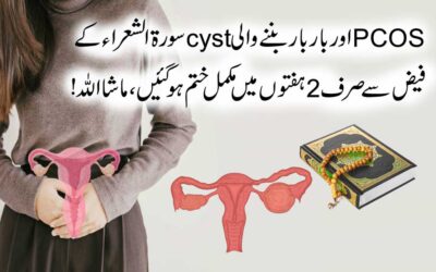 PCOS Se Fori Shifa Ka Naqsh
