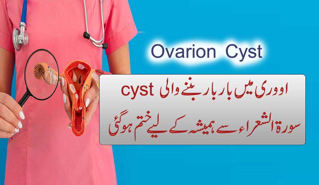 Cyst Pani Ki Theliyan Khatam Surah Shuara K Naqsh Se