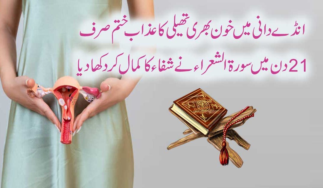 Ovarian Cyst Ka Taweez